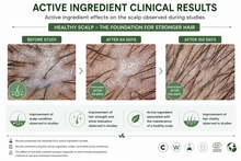 Load image into Gallery viewer, Scalp Mask - for Hair Growth and Strengthening 150g
